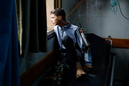 A Palestinian child wounded in Israeli strikes waits to receive treatment at Nasser hospital in Khan Younis