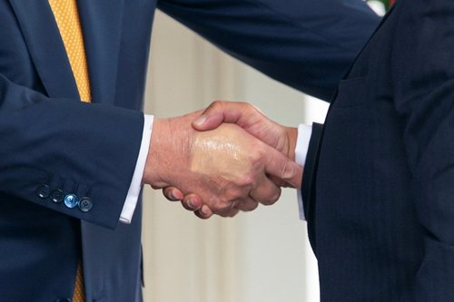 REUTERS Modrice na Trumpovoj ruci