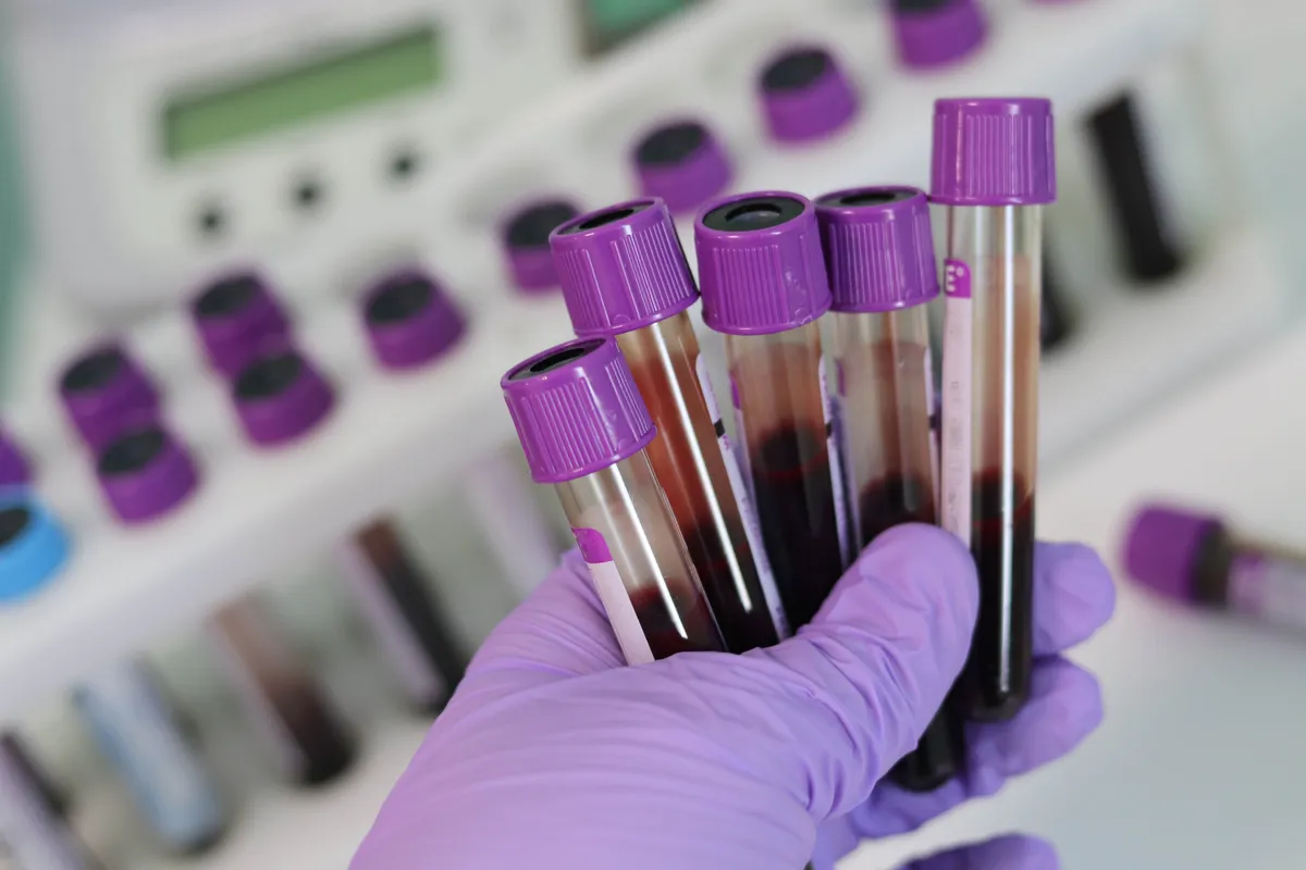 Preokret u borbi protiv raka: Ovaj test otkriva 50 vrsta godinama prije simptoma