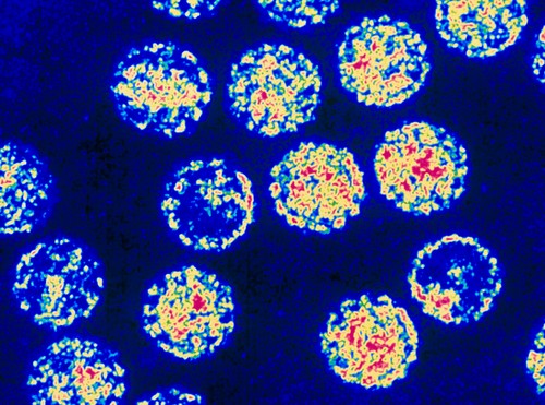 Coloured TEM of Papilloma viruses