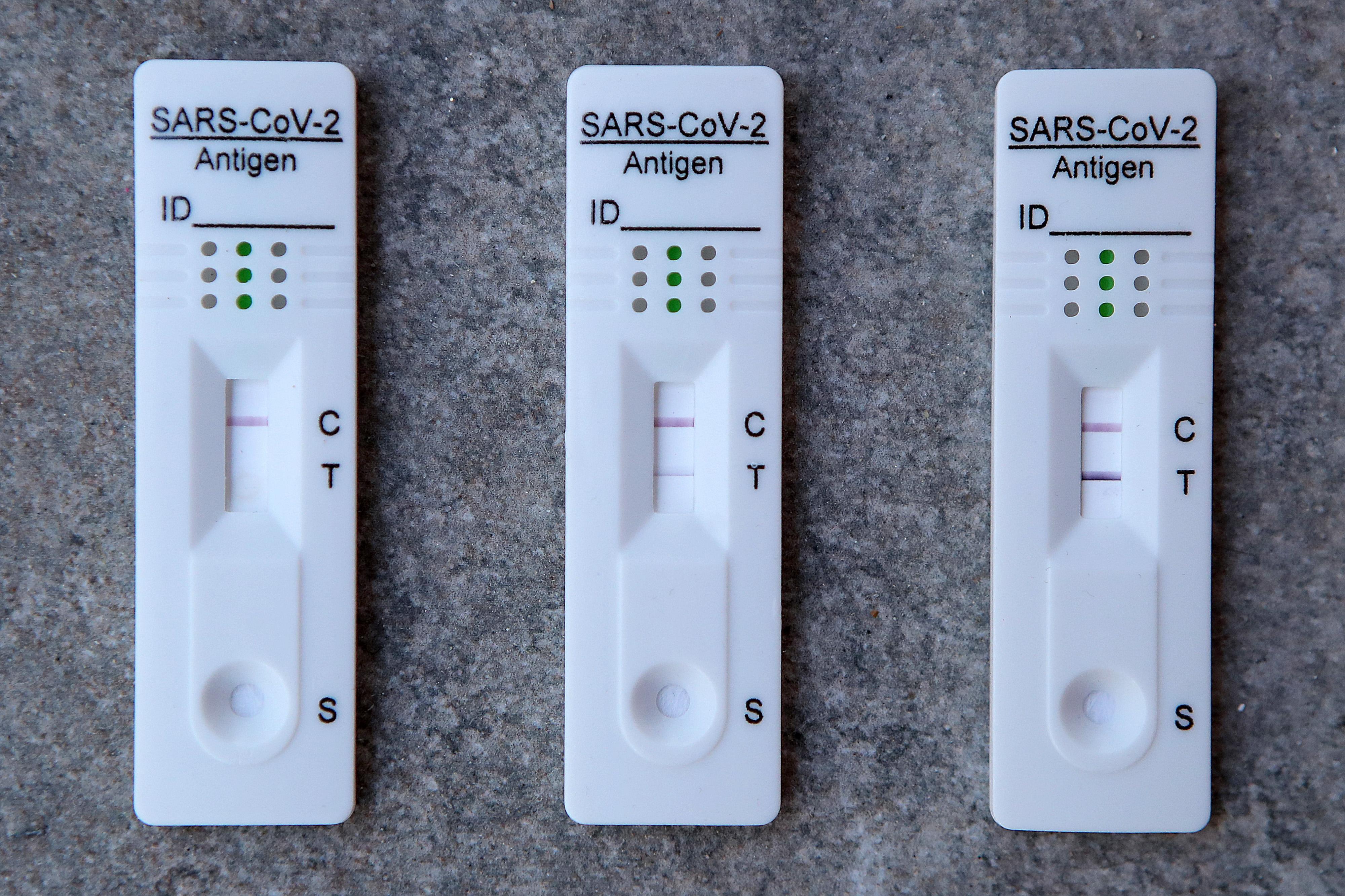 Brzi antigenski test