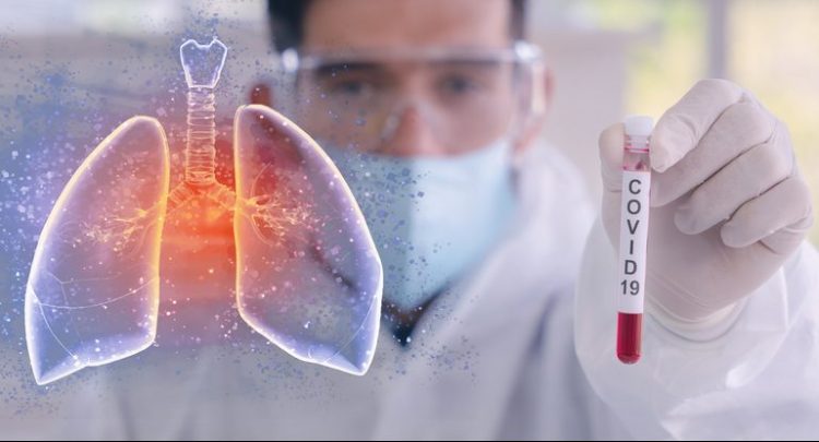 pluća, postcovid, dugi covid, covid, koronavirus