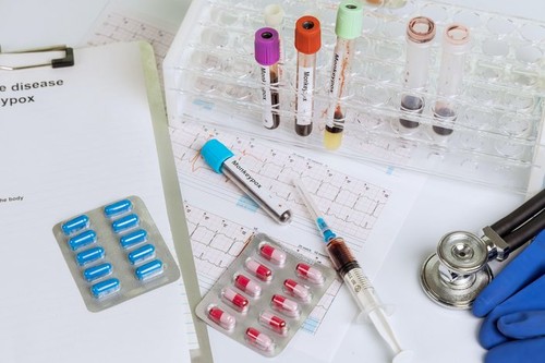 Blood sample with Monkeypox virus check-up analysis in laboratory with health analysis screening
