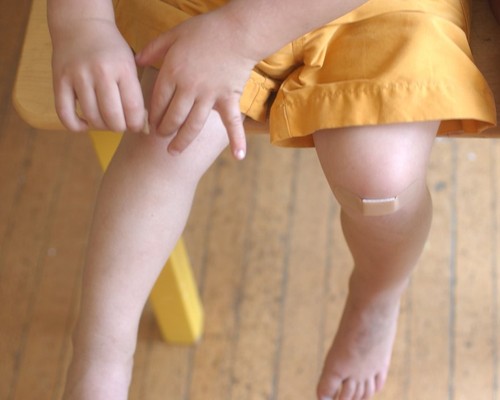 young child puts band aid on his knees caring for himself growth ouch