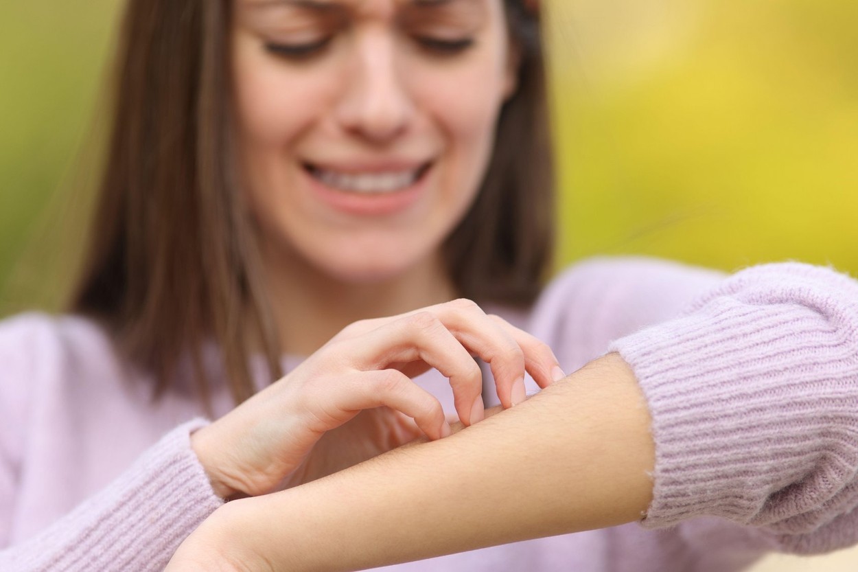 Front view close up of an stressed teen scratching itchy arm in a park