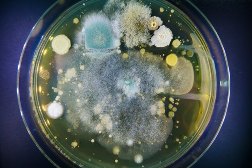 Petri dish with bacteria