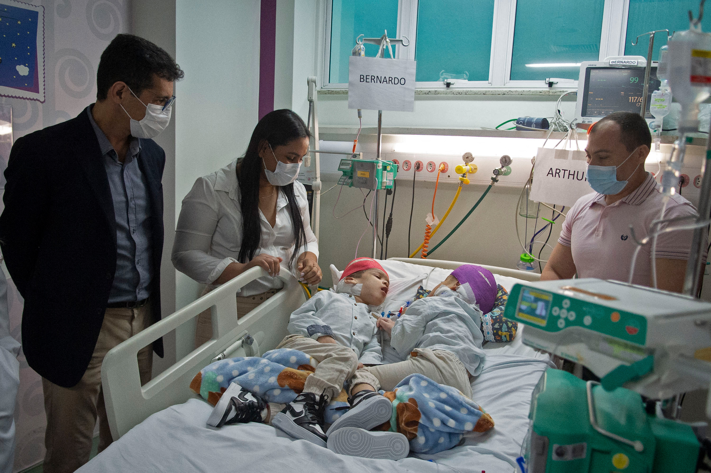 sijamski blizanci, brazil, Bernardo i Arthur Lima