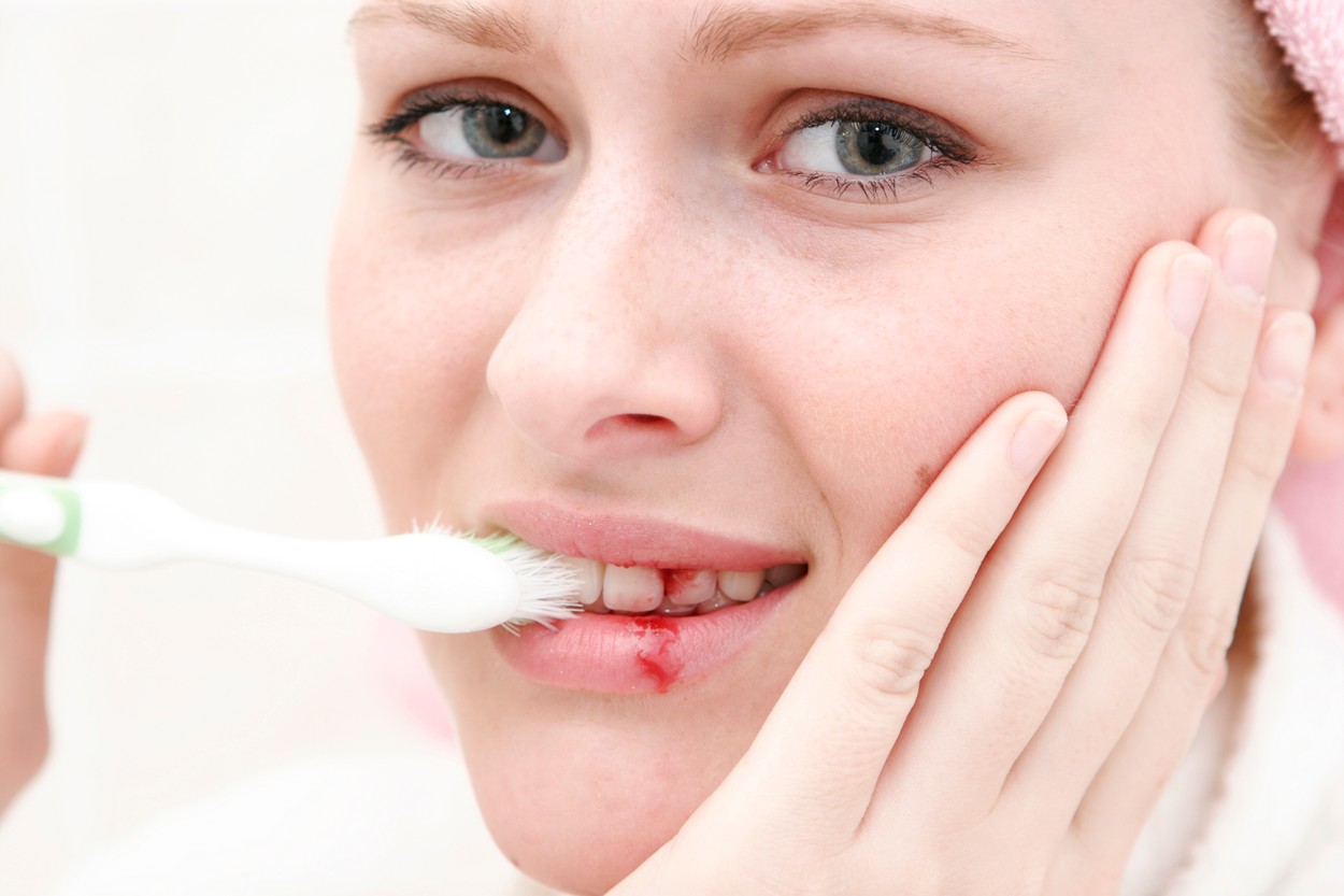 Young Woman Bleeding While Brushing Her Teeth