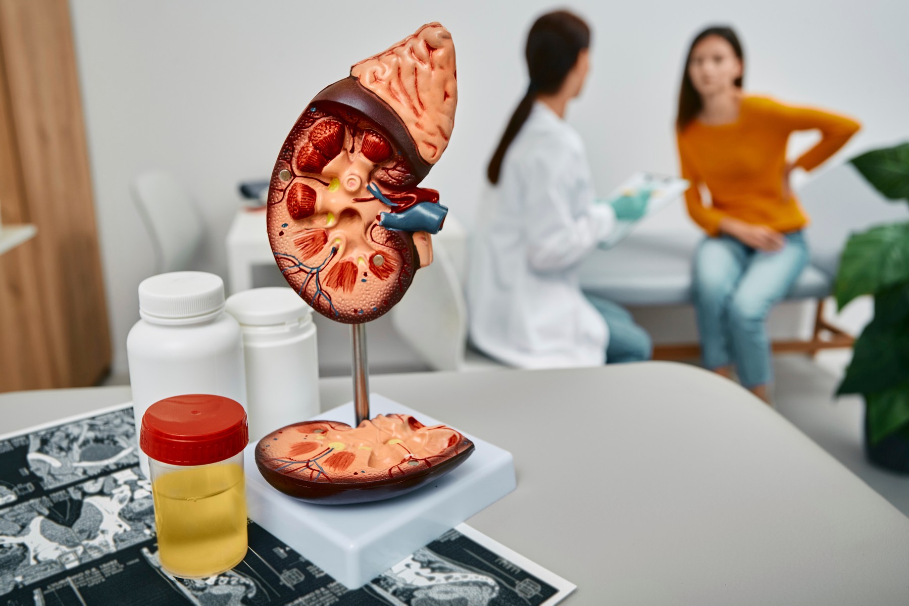 Kidney disease, conceptual image