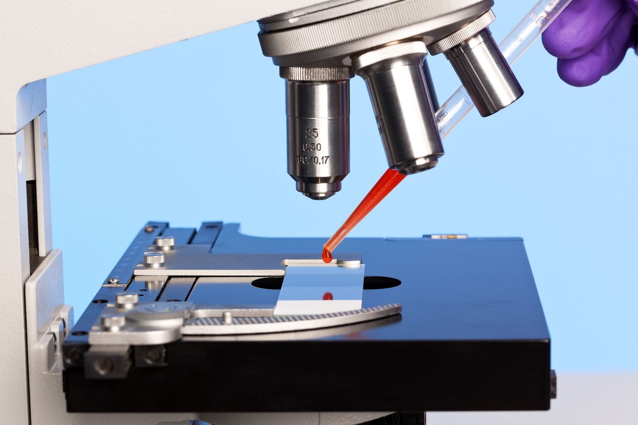 Photo of a laboratory microscope with a blood sample on a glass slide.