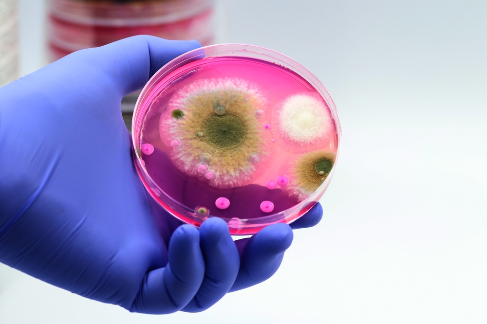 gljivice, gljivica, infekcija