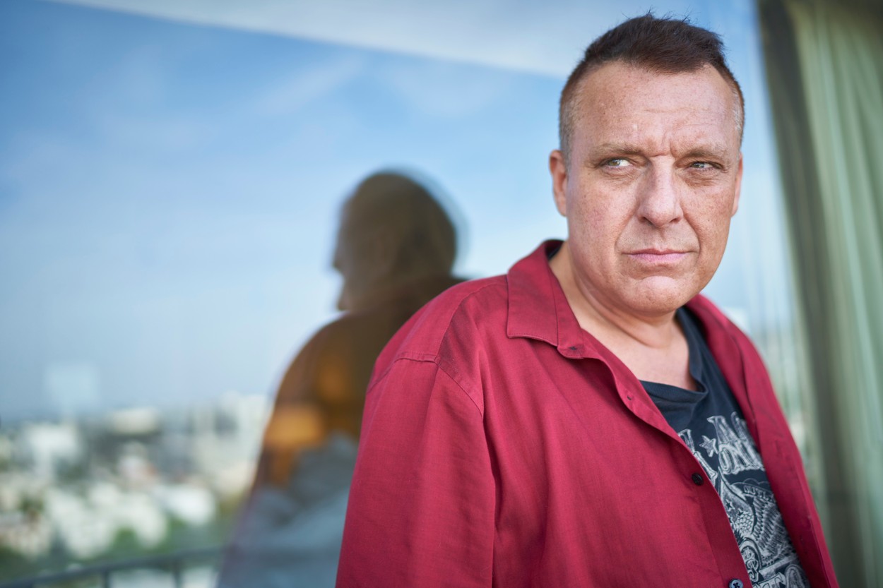 EXCLUSIVE: FILE PICS: Tom Sizemore, before and after hair transplant surgery