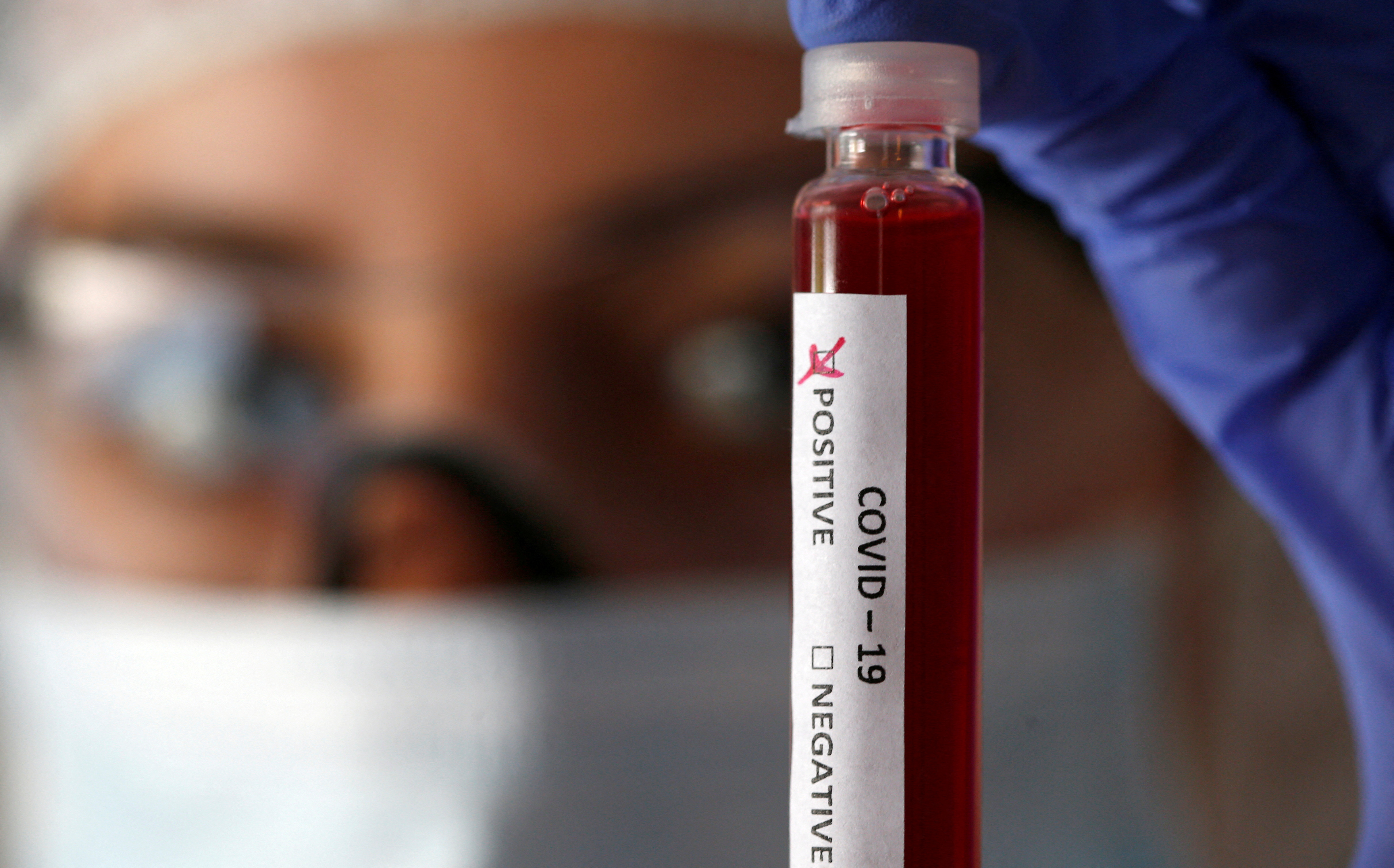 FILE PHOTO: Fake blood is seen in test tubes labelled with the coronavirus (COVID-19) in this illustration