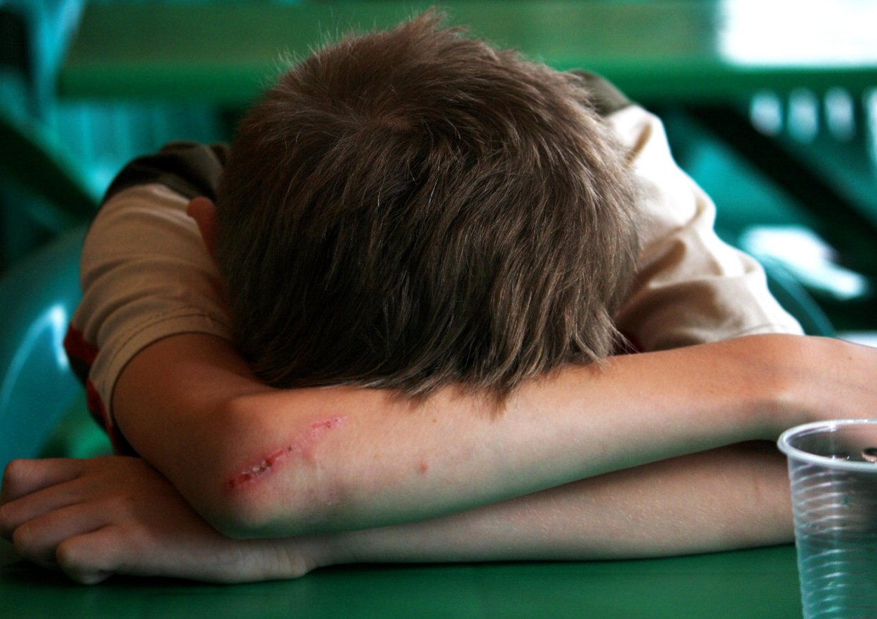A teenager with wounds on hand and the empty Cup on the table fell asleep in the cafe.