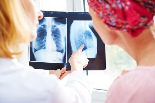 profi Cancer consultation