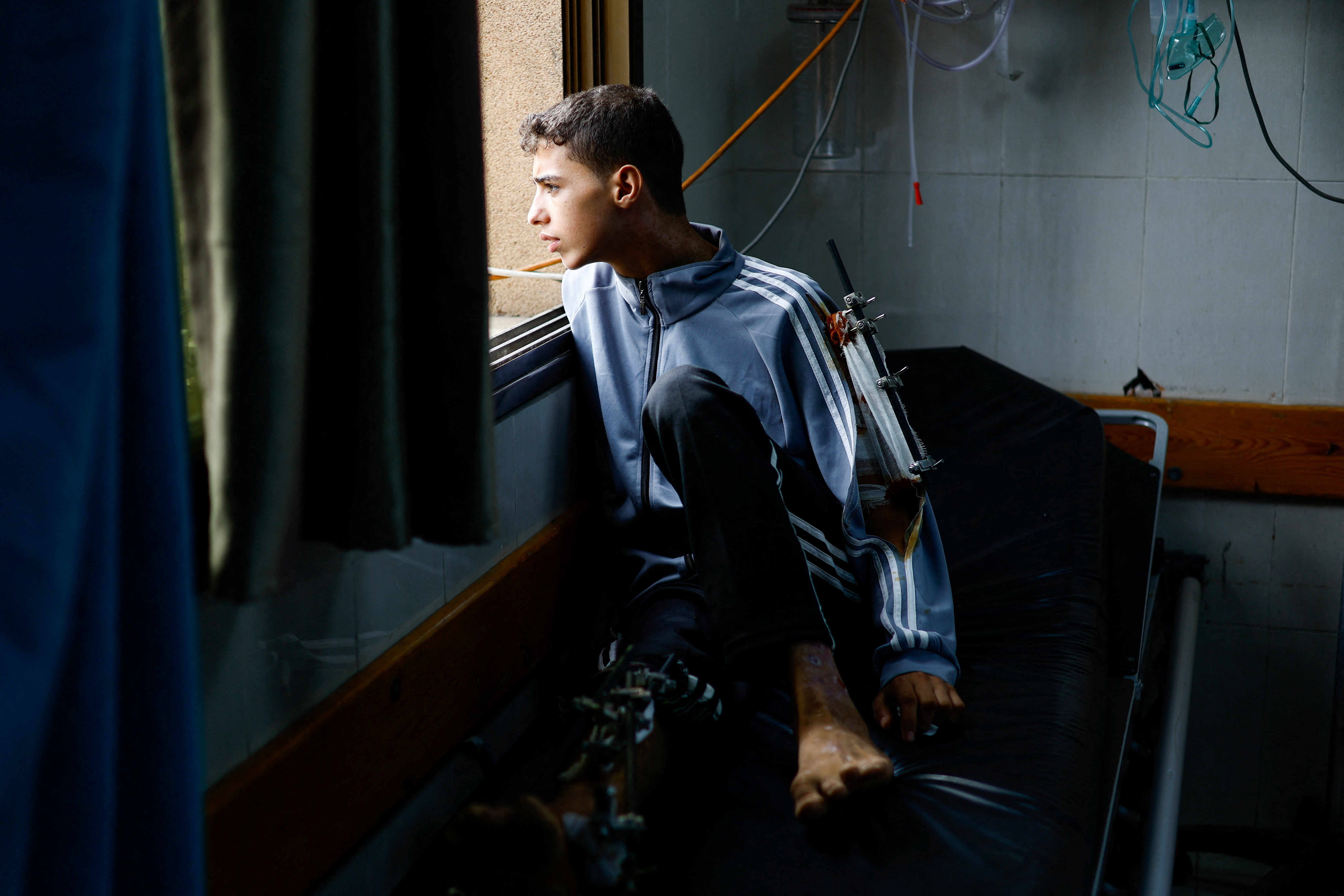 A Palestinian child wounded in Israeli strikes waits to receive treatment at Nasser hospital in Khan Younis