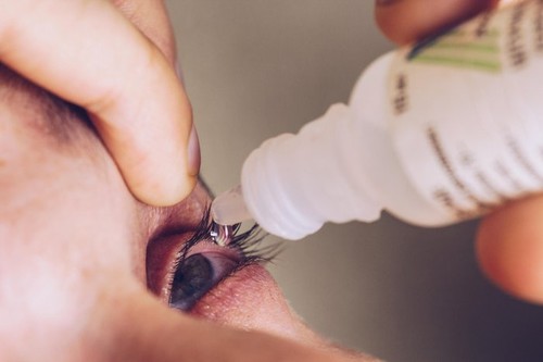 a man drips open human eye with bright red arteries drops to improve vision close up. irritation and redness of the eyeball. pupils, iris, eyelashes i