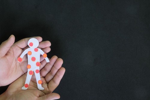 Pox disease such as monkeypox, smallpox and chicken pox care, prevention and protection concept. Hand holding human body cutout with red rash sores