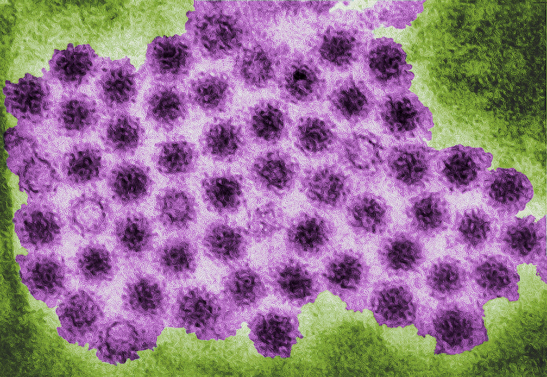 NOROVIRUS