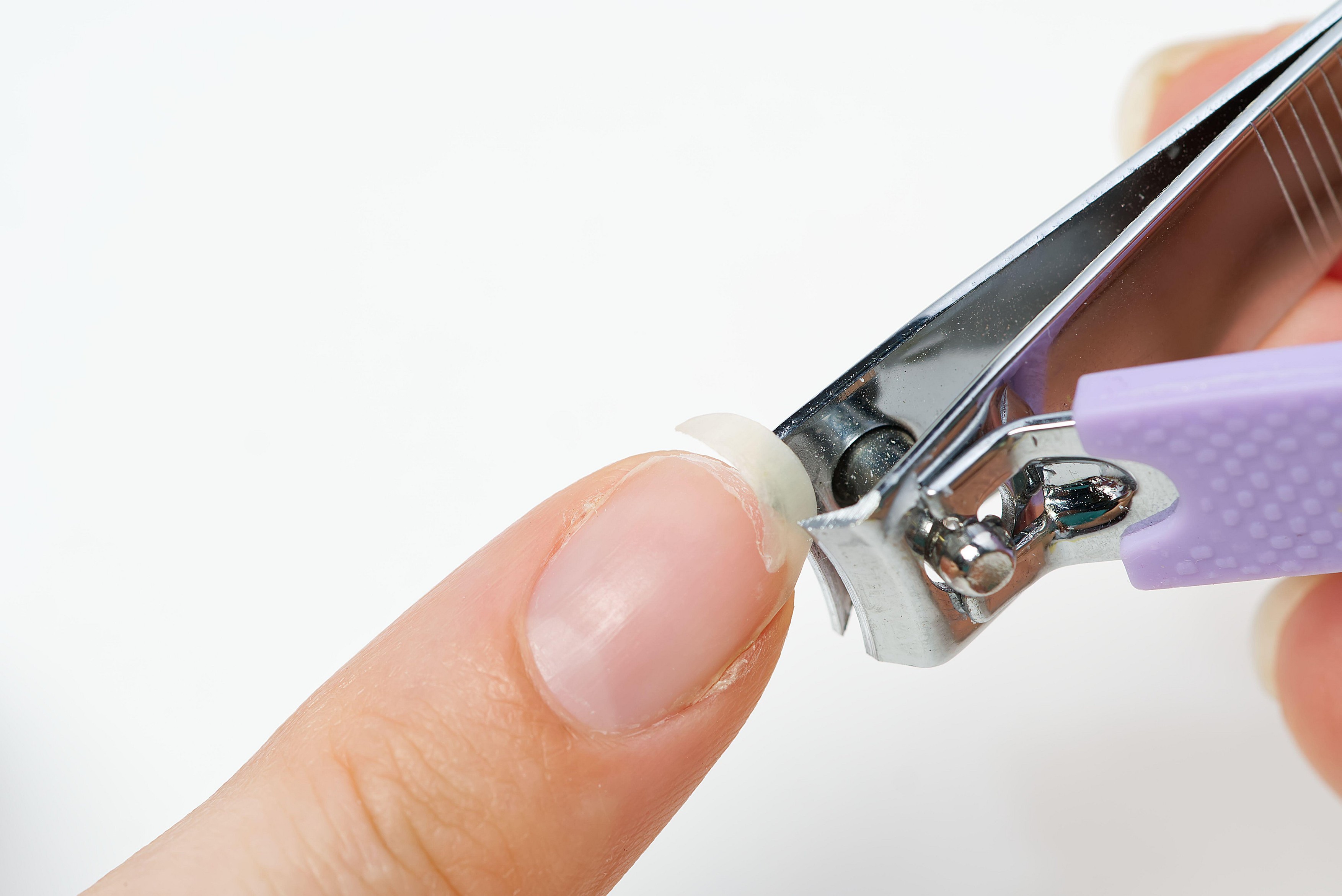 nokti, nokat, slomljeni nokat