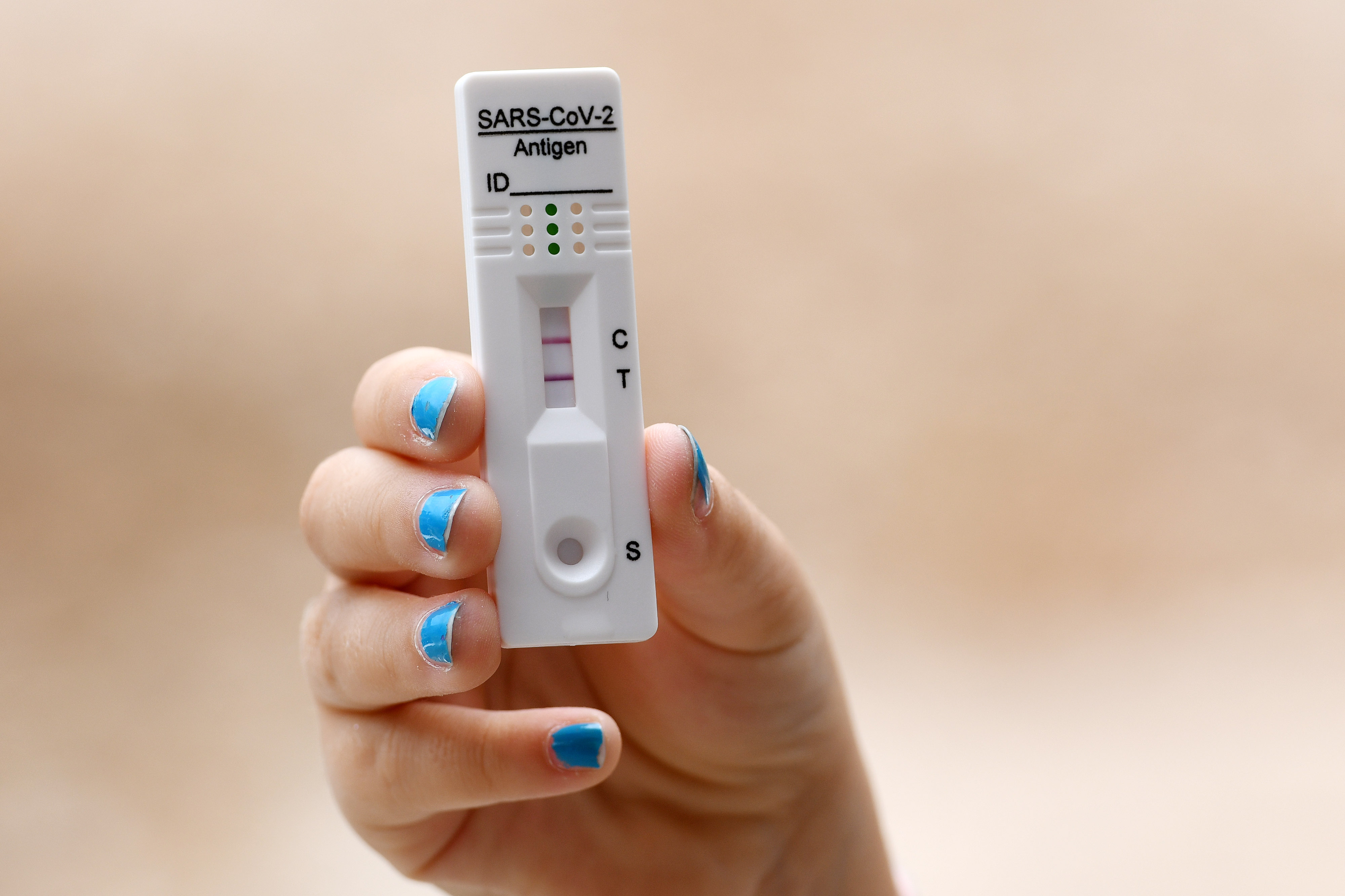 Pozitivan test na koronavirus