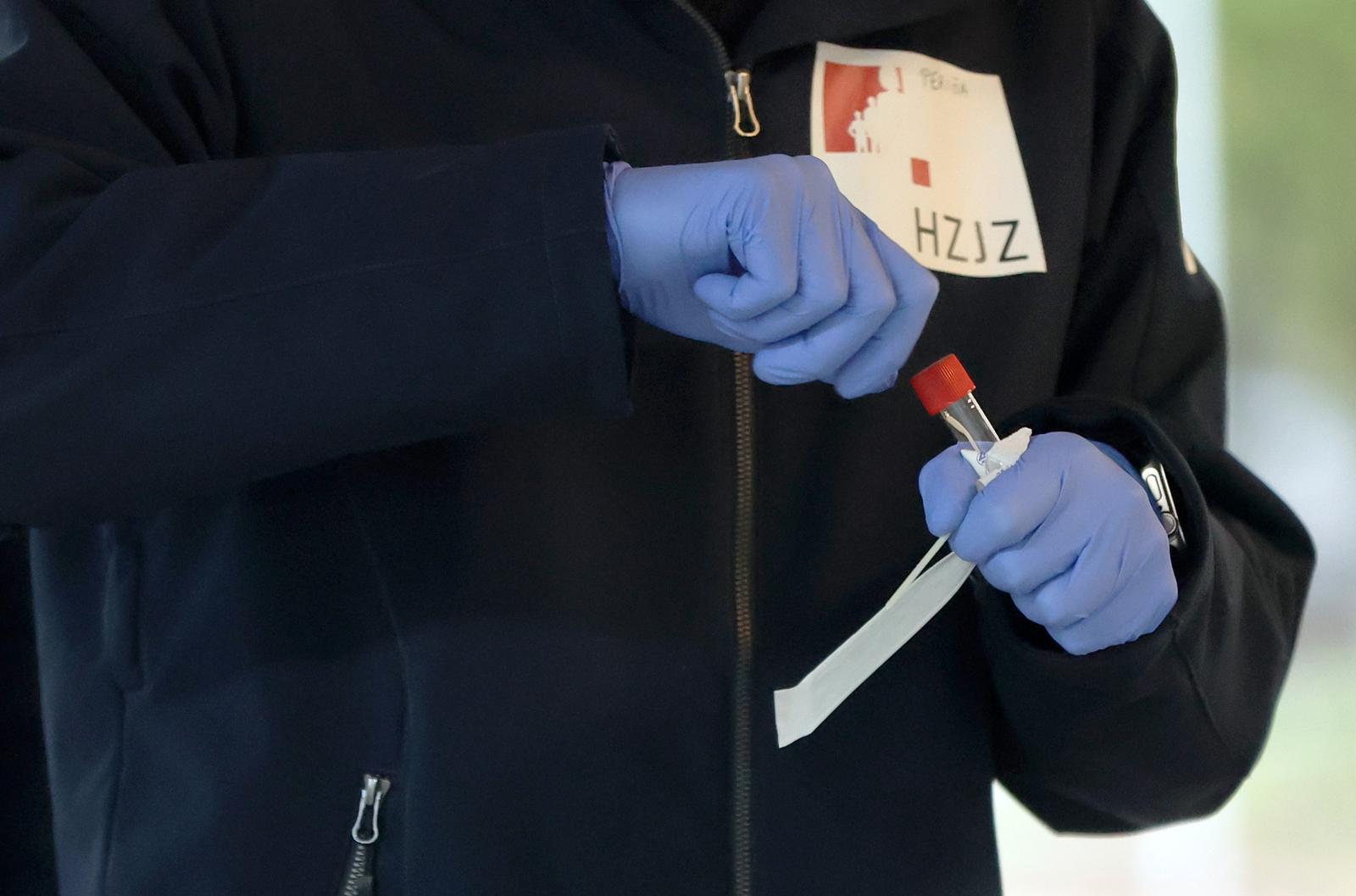 Zagreb: Testiranje na hripavac u NZJZ "Andrija Štampar"