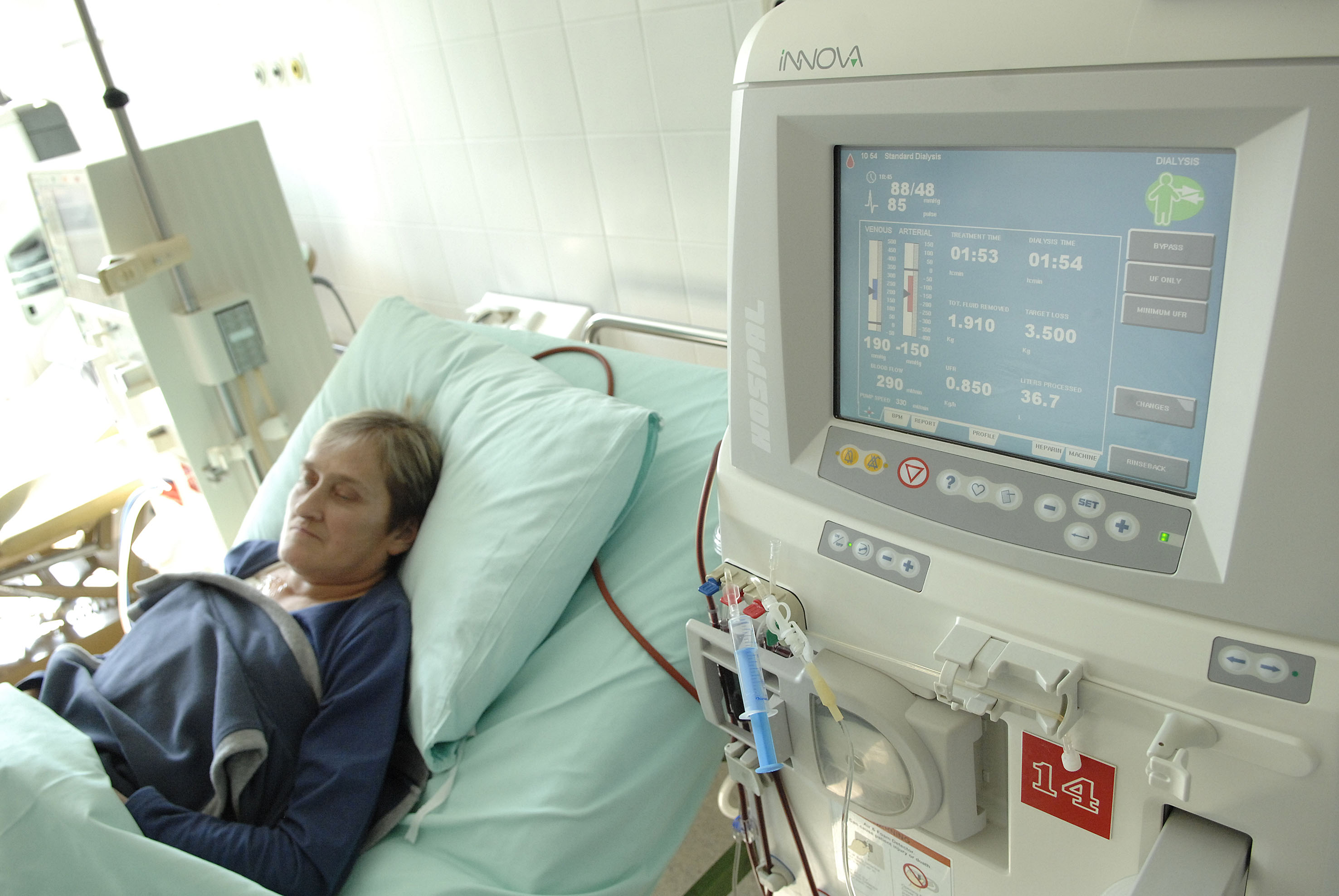 ?akovec: Ivanka Sabol 28 godina ?eka bubreg