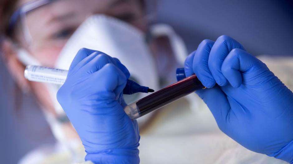 2020-05-19T125619Z_1052911345_RC2ORG9MNGT0_RTRMADP_3_HEALTH-CORONAVIRUS-RKI-STUDY