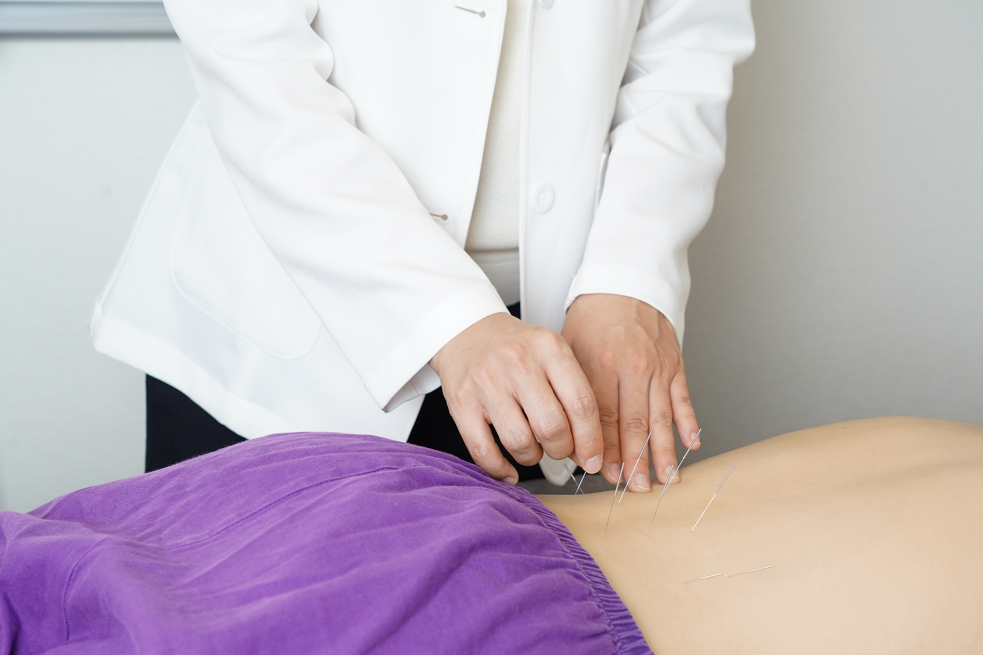 Akupunktura - pixabay