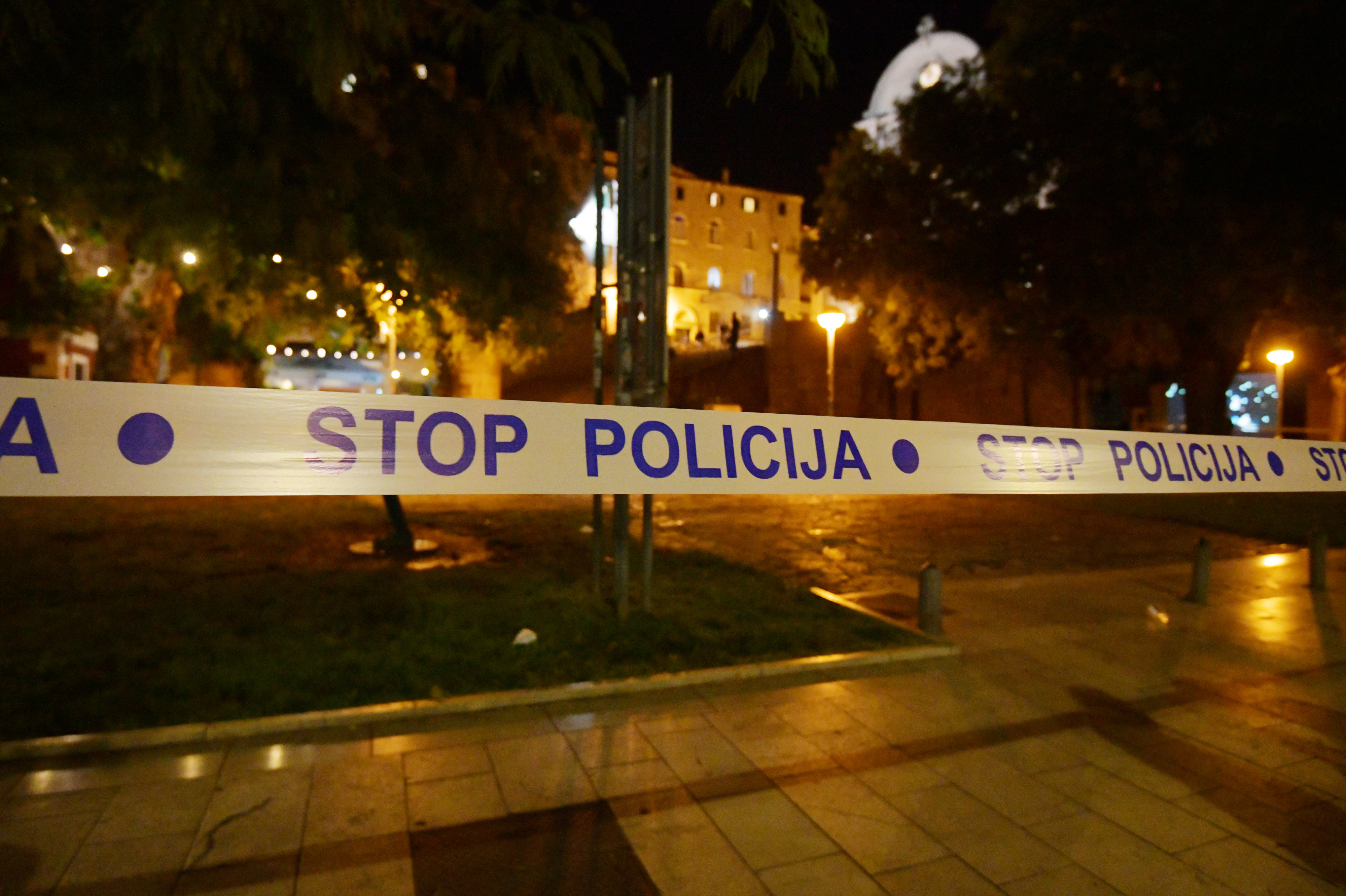 Zena ozlijedjena pirotehnickim sredstvom na svadbi. Photo: Hrvoje Jelavic/PIXSELL