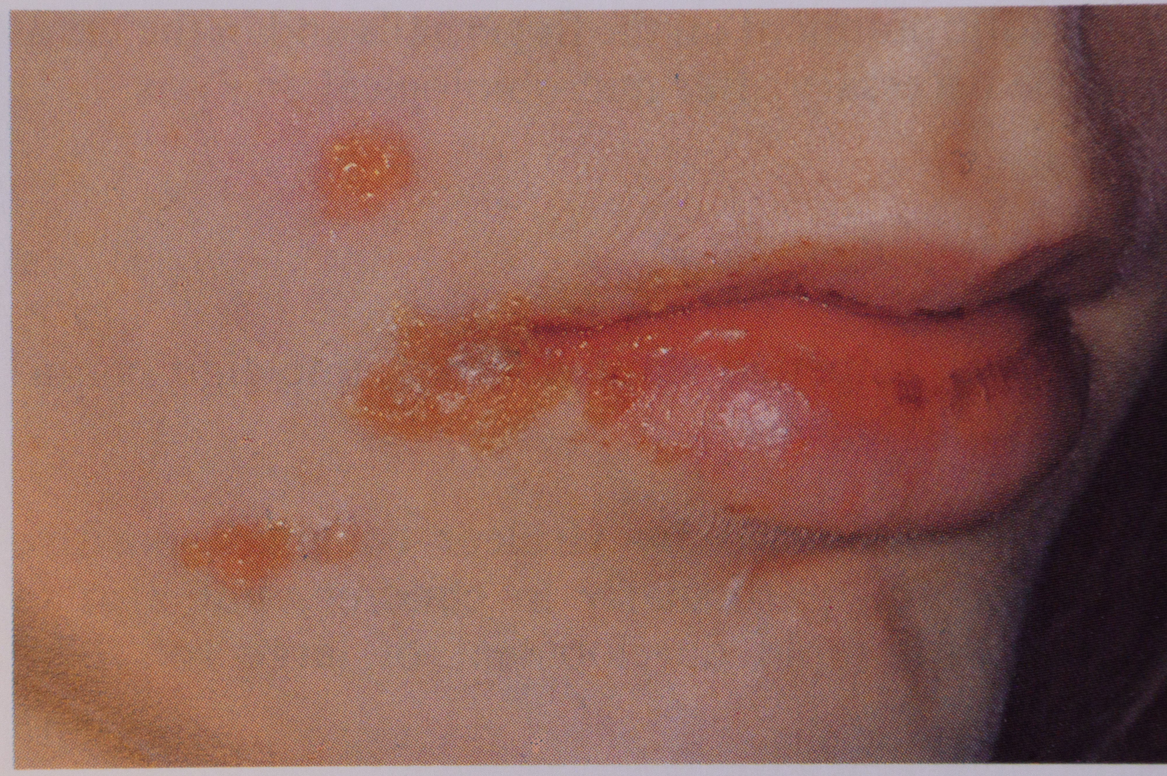 10.08.2021., Zadar - mr. sc. dr. Gordana Bubicic - Bajek, dermatolog. Impetigo, kozna bolest. "nPhoto: Dino Stanin/PIXSELL
