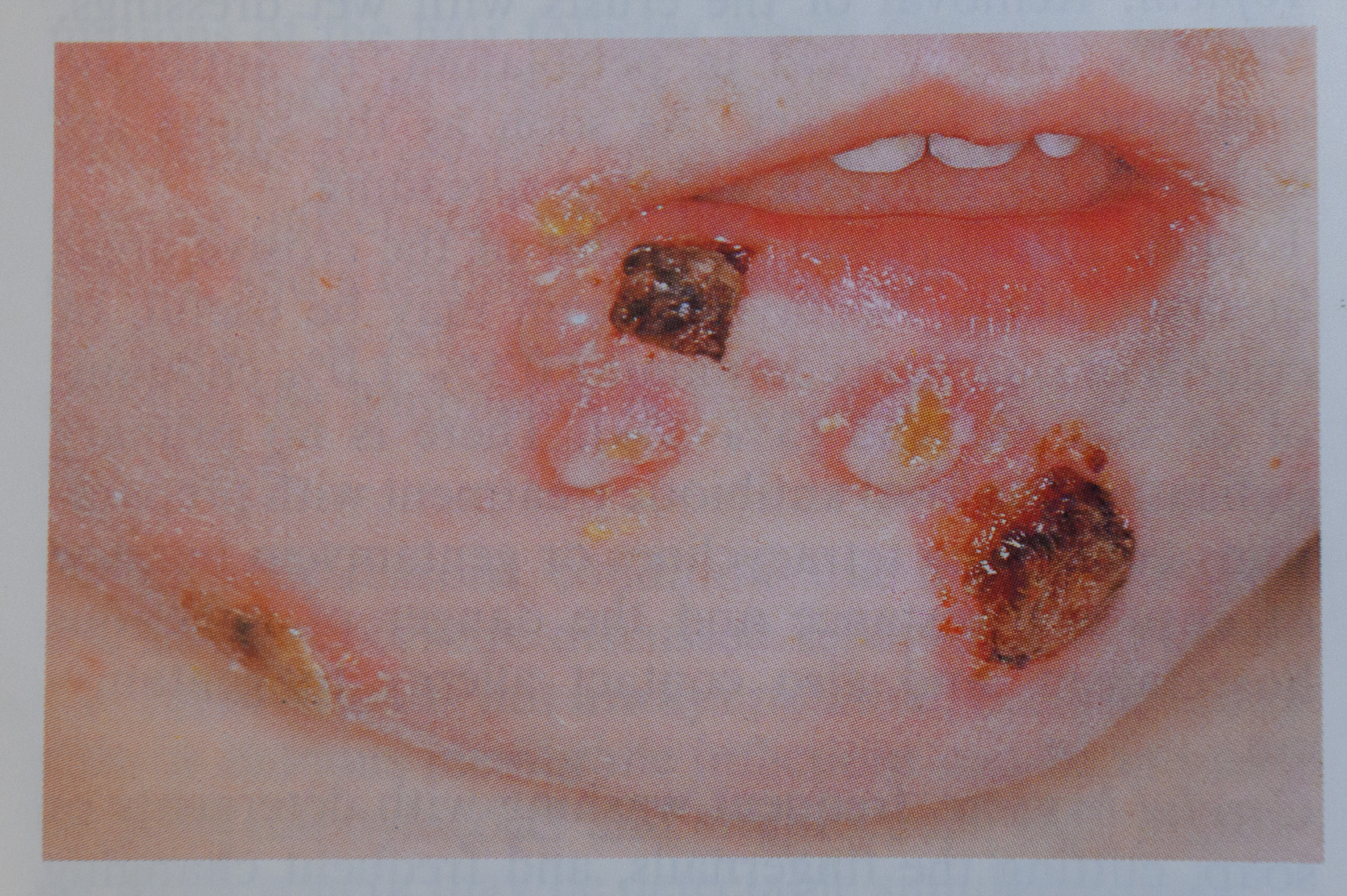 10.08.2021., Zadar - mr. sc. dr. Gordana Bubicic - Bajek, dermatolog. Impetigo, kozna bolest. "nPhoto: Dino Stanin/PIXSELL