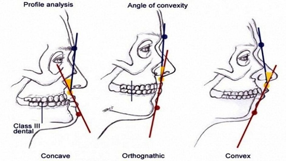 a77894f03b2858018430