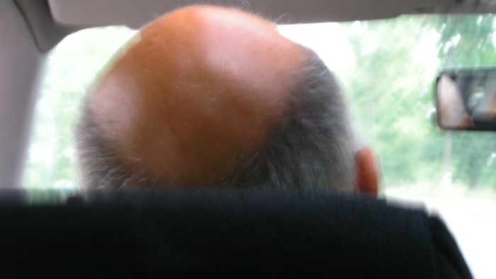 Celavost_Muskarac_MorgueFile