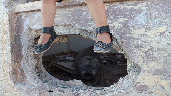 djecje nogice u Gazi_Anadolija_Eyad Amer