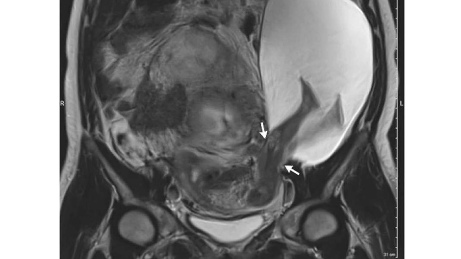 extra_large-1482496179-cover-image