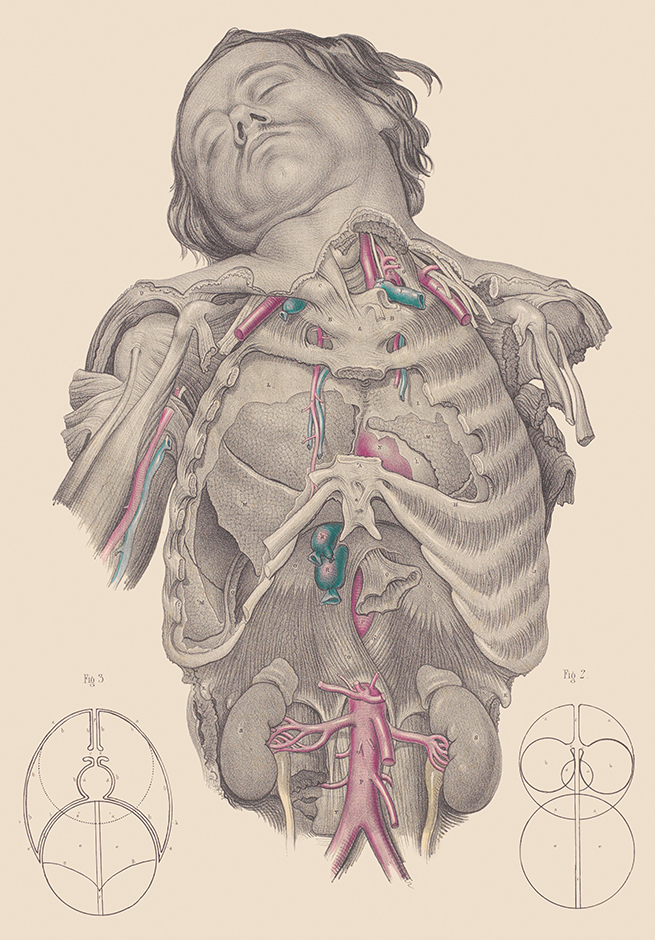 Image © Wellcome Collection