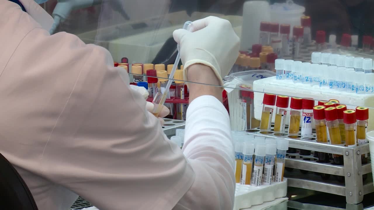 I u Hrvatskoj kreću serološka ispitivanja, ali za sada ne i za građane