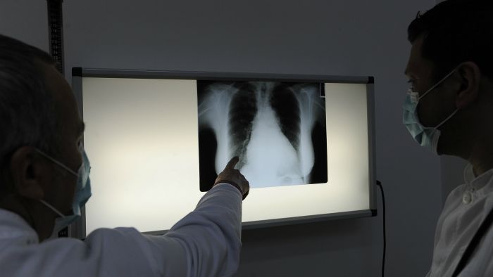 infektologija_gripa3-220115