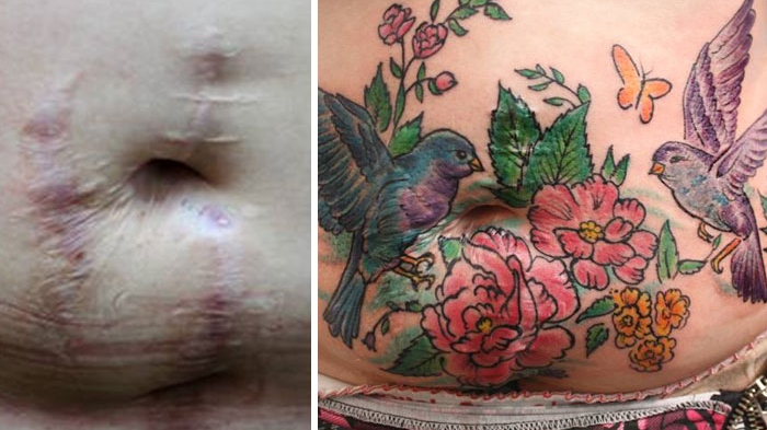 mastectomy-abuse-scar-women-free-tattoo-flavia-carvalho-daedra-art-brasil-5