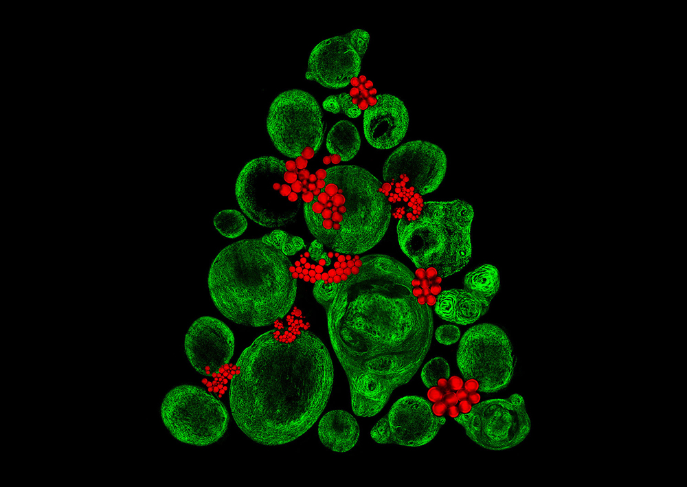 Catarina Moura, Sumeet Mahajan, Richard Oreffo & Rahul Tare