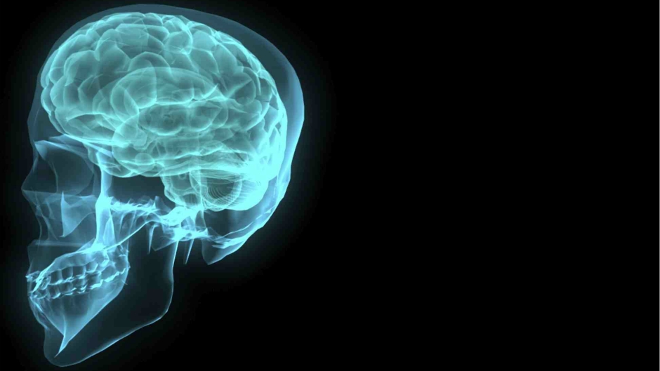 mozak-glava-rendgen-freeimages-obscenity-1220.jpeg