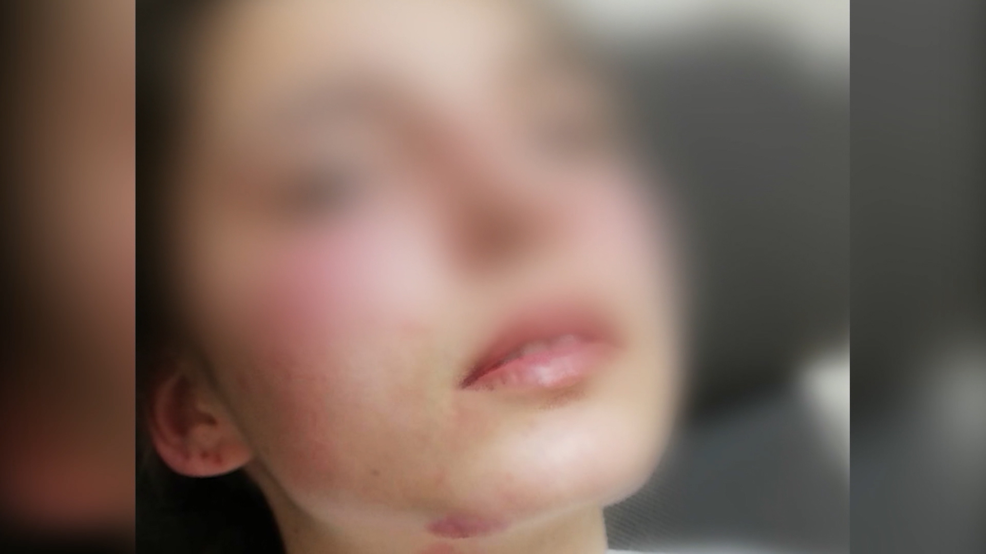 pretučena djevojčica