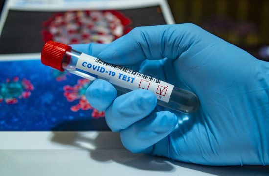 covid, covid-19, koronavirus, korona, test, testiranje