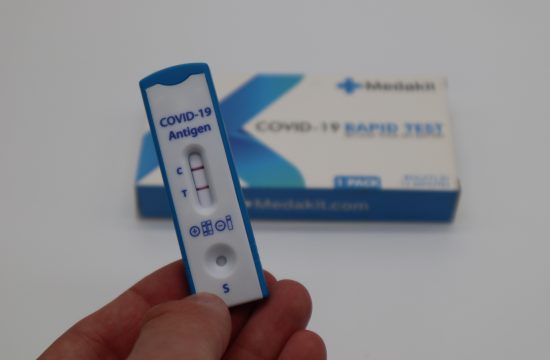 covid, koronavirus, testiranje, test na koronu, pcr test, brzi test