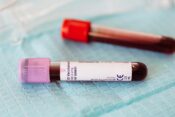 kako saznati krvnu grupu