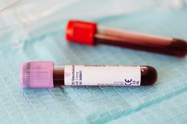 kako saznati krvnu grupu